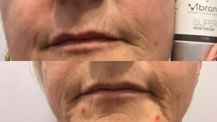 Product image of Super C Serum